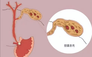 微信截图_20241121152742.png